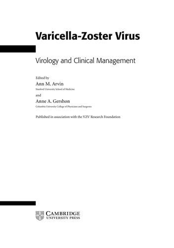 Varicella-zoster virus