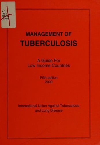 Management of tuberculosis