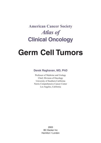 Germ cell tumors