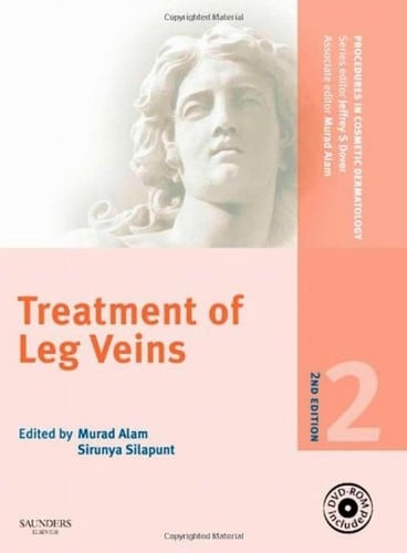 Treatment of leg veins