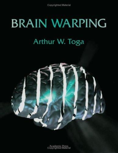 Brain Warping