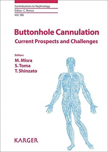 Buttonhole Cannulation Current Prospects and Challenges