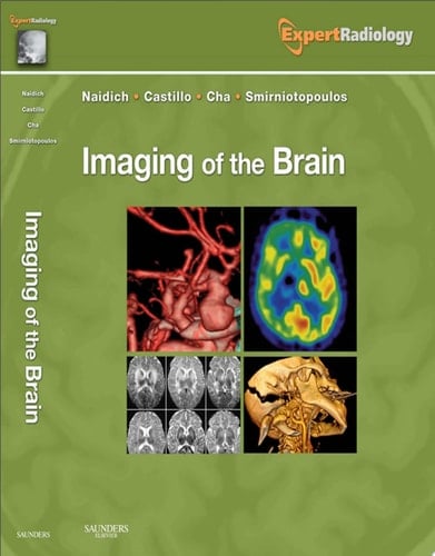 Imaging of the Brain E-Book Expert Radiology Series