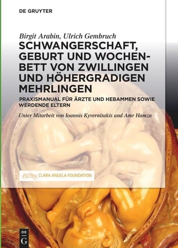 Schwangerschaft, Geburt und Wochenbett von Zwillingen und höhergradigen Mehrlingen Praxismanual für Ärzte und Hebammen sowie werdende Eltern