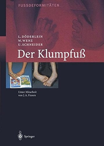 Fussdeformitäten 1. Der Klumpfuß. Erscheinungsformen und Behandlungsprinzipien jeden Alters. Differentialdiagnose und Differentialtherapie.