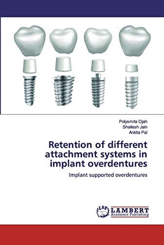 Retention of different attachment systems in implant overdentures: Implant supported overdentures