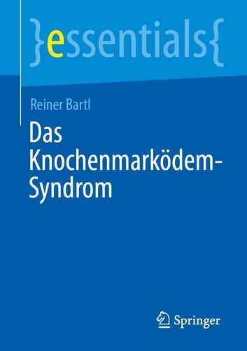 Das Knochenmarködem-Syndrom Fortschritte in Diagnose und Therapie