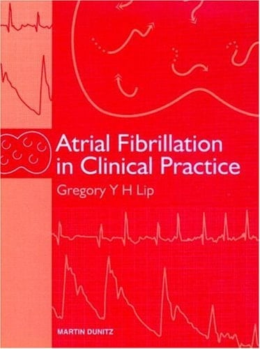 Atrial Fibrillation in Clinical Practice