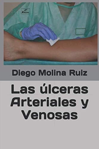Las úlceras Arteriales y Venosas (Recursos didácticos de apoyo al estudio) (Spanish Edition)