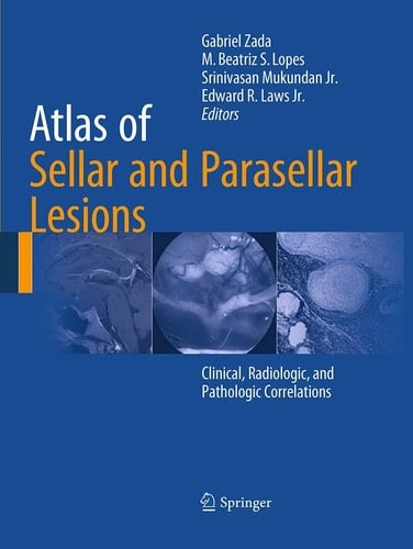 Atlas of Sellar and Parasellar Lesions Clinical, Radiologic, and Pathologic Correlations