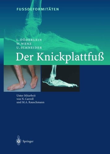 FussdeformitÄten Der Knickplattfuss