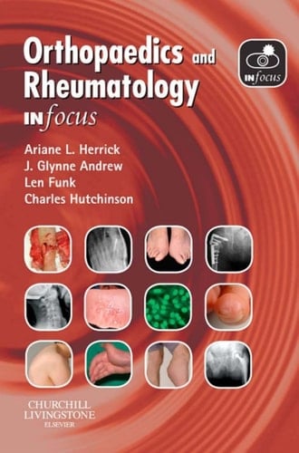 Orthopaedics and Rheumatology In Focus E-Book