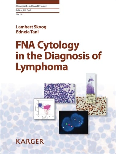 FNA Cytology in the Diagnosis of Lymphoma In collaboration with A. Porwit (Stockholm)