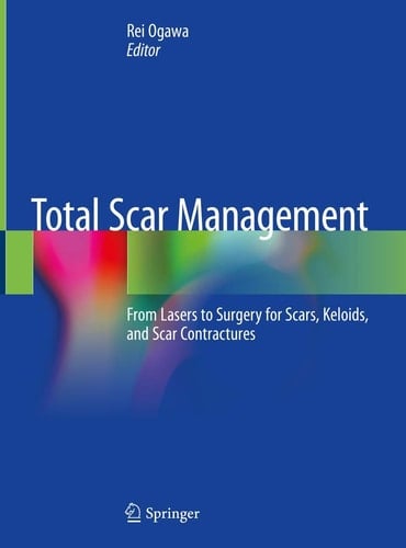 Total Scar Management From Lasers to Surgery for Scars, Keloids, and Scar Contractures