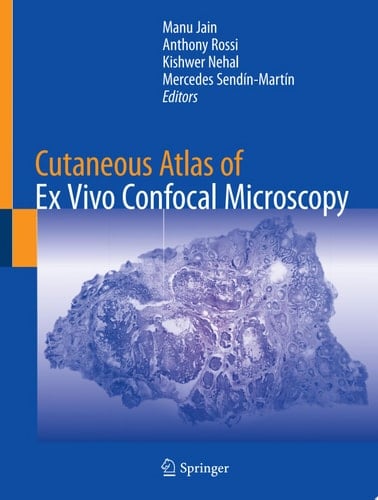 Cutaneous Atlas of Ex Vivo Confocal Microscopy