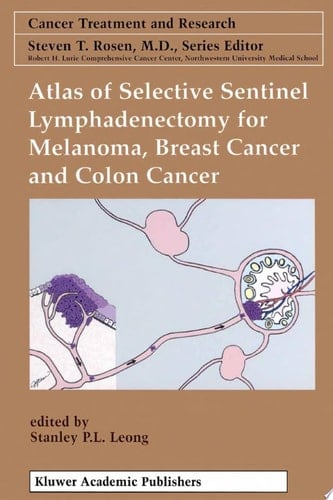 Atlas of Selective Sentinel Lymphadenectomy for Melanoma, Breast Cancer and Colon Cancer