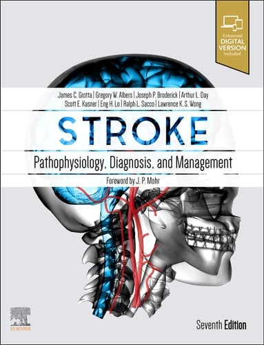 Stroke Pathophysiology, Diagnosis, and Management