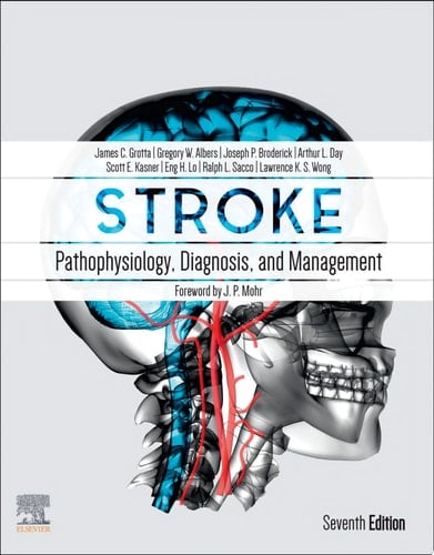 Stroke E-Book Pathophysiology, Diagnosis, and Management