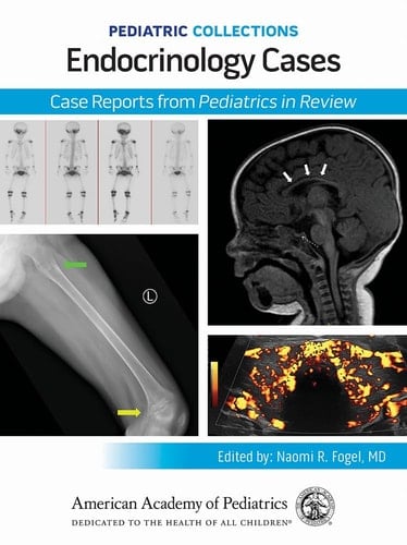 Pediatric Collections: Endocrinology Cases: Case Reports from Pediatrics in Review