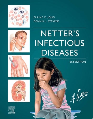 Netter's Infectious Diseases - E-Book Netter's Infectious Diseases - E-Book