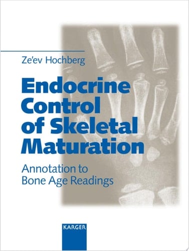 Endocrine Control of Skeletal Maturation Annotation to Bone Age Readings