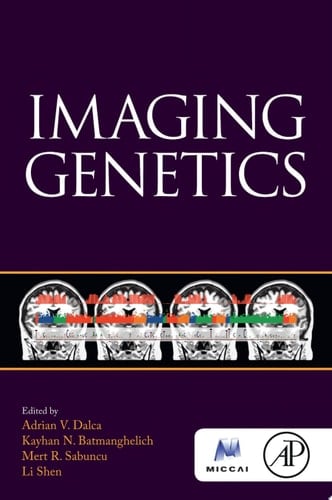 Imaging Genetics