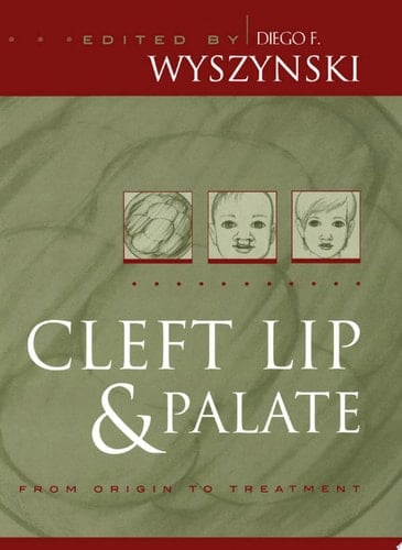 Cleft Lip and Palate: From Origin to Treatment