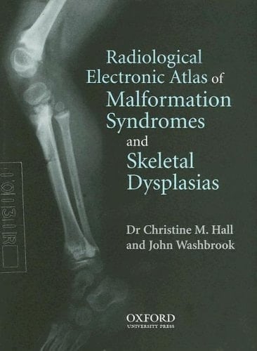 Radiological Atlas of Malformation Syndromes and Skeletal Dysplasias