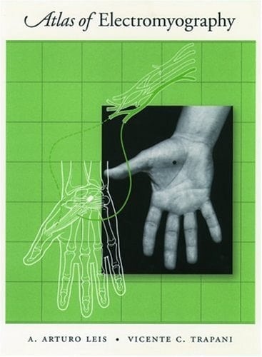 Atlas of Electromyography