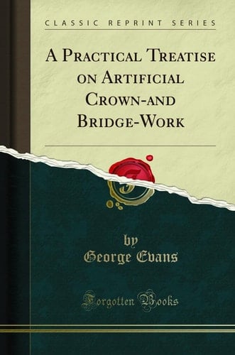 A Practical Treatise on Artificial Crown-And Bridge-Work (Classic Reprint)