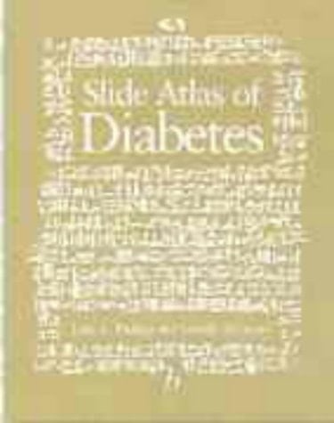 Textbook of Diabetes