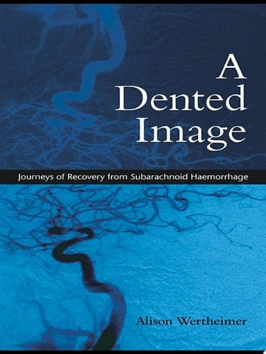 A Dented Image