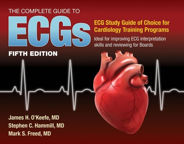 The Complete Guide to ECGs: A Comprehensive Study Guide to Improve ECG Interpretation Skills A Comprehensive Study Guide to Improve ECG Interpretation Skills