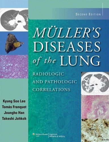Muller's Diseases of the Lung Radiologic and Pathologic Correlations