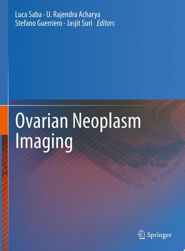 Ovarian Neoplasm Imaging