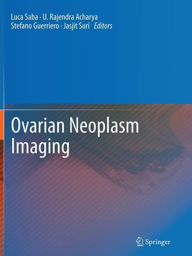 Ovarian Neoplasm Imaging
