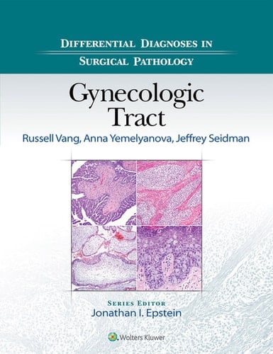Differential Diagnoses in Surgical Pathology Gynecologic Tract