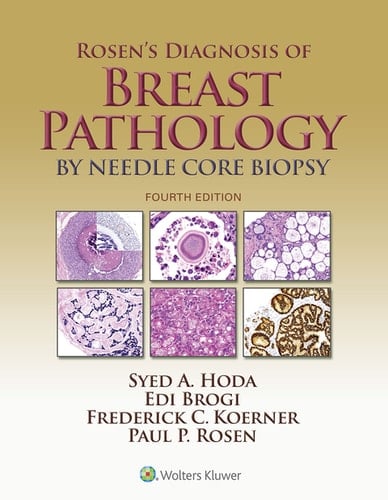 Rosen's Diagnosis of Breast Pathology by Needle Core Biopsy