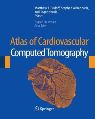 Atlas of Cardiovascular Computed Tomography: includes narrated videos