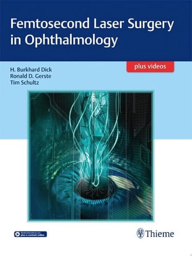Femtosecond Laser Surgery in Ophthalmology