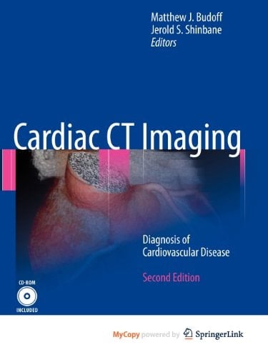 Cardiac CT Imaging