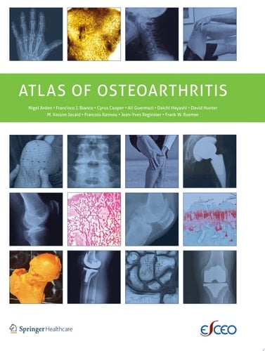 Atlas of Osteoarthritis