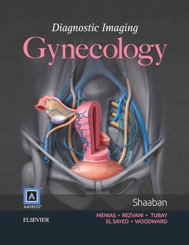 Diagnostic Imaging Gynecology