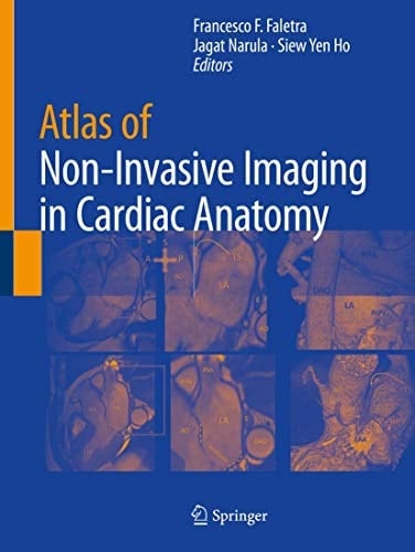 Atlas of Non-Invasive Imaging in Cardiac Anatomy