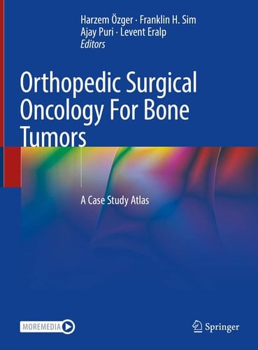 Orthopedic Surgical Oncology For Bone Tumors A Case Study Atlas