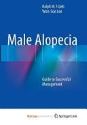 Male Alopecia Guide to Successful Management
