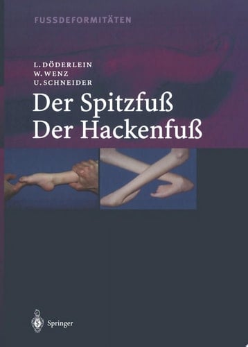 Fussdeformitäten