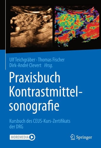 Praxisbuch Kontrastmittelsonografie Kursbuch des CEUS-Kurs-Zertifikats der DRG