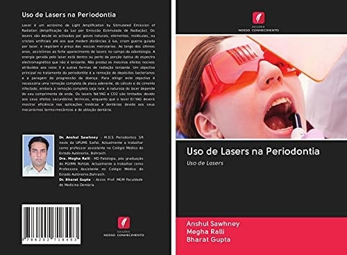 Uso de Lasers na Periodontia: Uso de Lasers (Portuguese Edition)