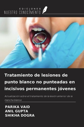 Tratamiento de lesiones de punto blanco no punteadas en incisivos permanentes jóvenes: Actualización sobre el tratamiento de la lesión anterior de la mancha blanca (Spanish Edition)